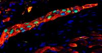 Human Heart Precursor Cells Self-Organised Into Human Muscle Fiber In Damaged Mouse Heart