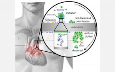 Illustration Showing Stages of Staphylococcus aureus Biofilm Formation on Prosthetic Heart Valves