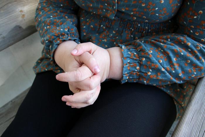A tell-tale symptom – cuffs around the wrist