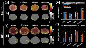 Figure 2. Optoacoustic and thermally excited third-order nonlinear susceptibility (TETONS) imaging data acquired in vivo for mice fed a high fat diet (HFD) or control (CTRL) diet.