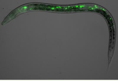 Reprogramming Germ Cells as Neurons (4 of 5)