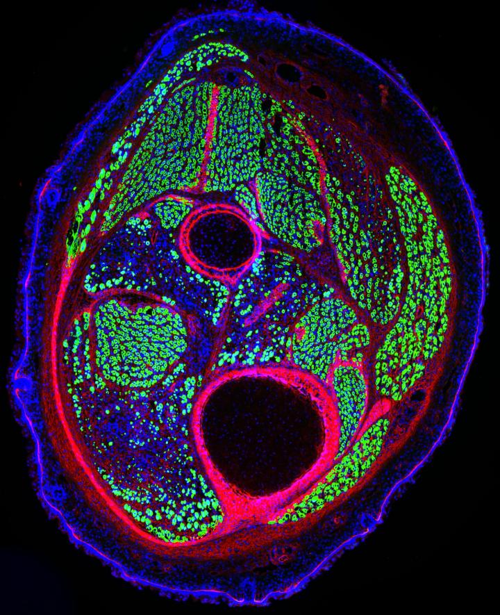 Developing Muscle in a Mouse Leg