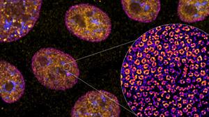 Microscopic view of cells exposed to Apt1