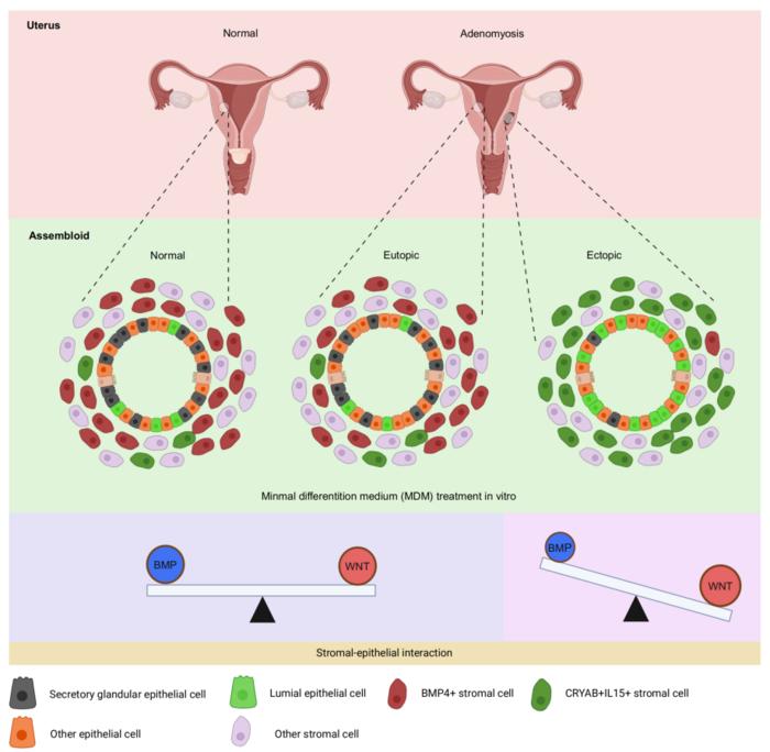 Unique Characteristics of Adenomyosis Lesion-Derived Assembloids
