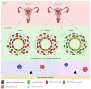 Unique Characteristics of Adenomyosis Lesion-Derived Assembloids