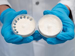 Fungal culture