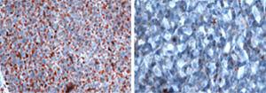 Lipid Stain