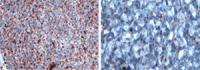Lipid Stain