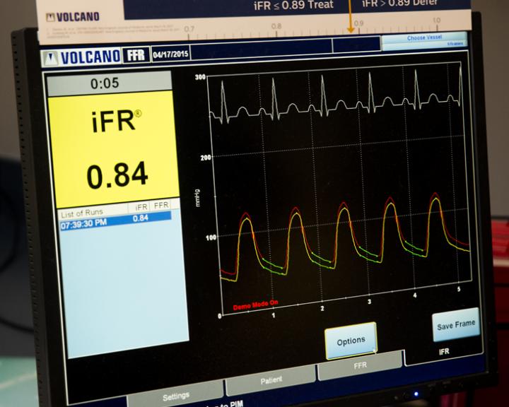 Non-Invasive Technology Is a Money-Saver for Heart Patients Needing PCI