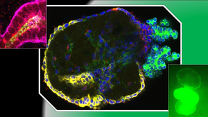 PKC lab image