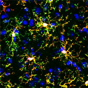 Transplanted microglia