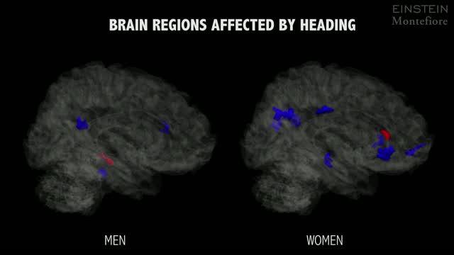 Brain Regions Affected by Heading