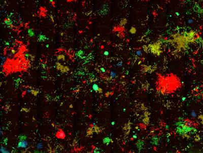 Reprogrammed Cells