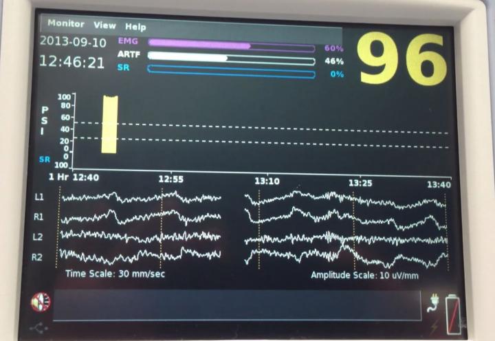 Waves on the Monitor