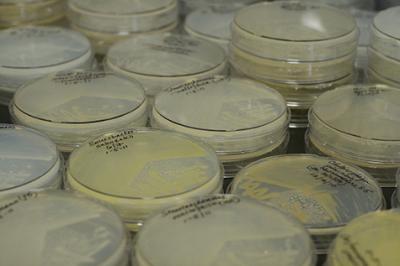 Bacteria Carried as Weapons?