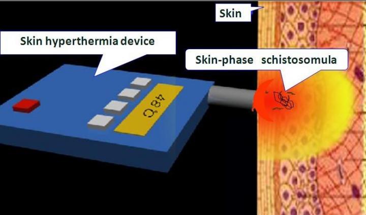 Skin Hyperthermia