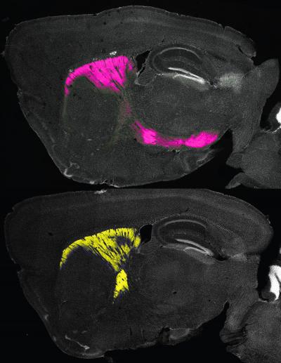 Longitudinal Cut 