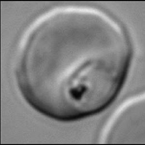 Infected Red Blood Cell