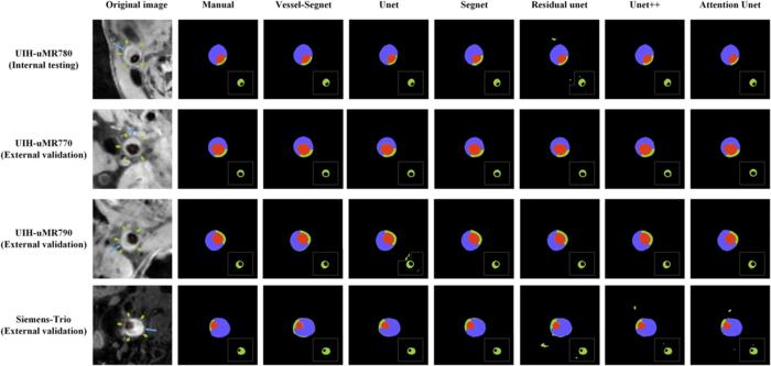 Comparison of segmentation results for lumens, vessel walls, and plaques across different models
