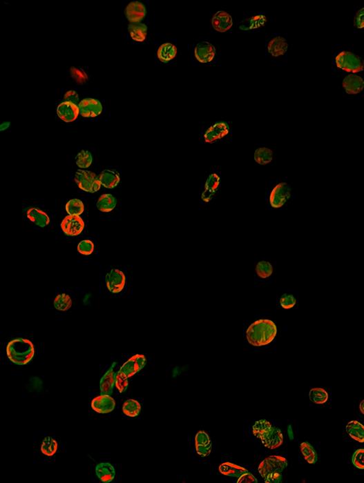 Platelet SEC61B