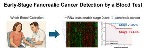 Figure2. Early-stage pancreatic cancer detection by a blood test.