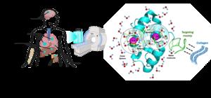 New MRI Agent Detects Lung Cancer, Hidden Metastases Earlier Than Current Scans New MRI Agent Detects Lung Cancer, Hidden Metastases Earlier Than Current Scans