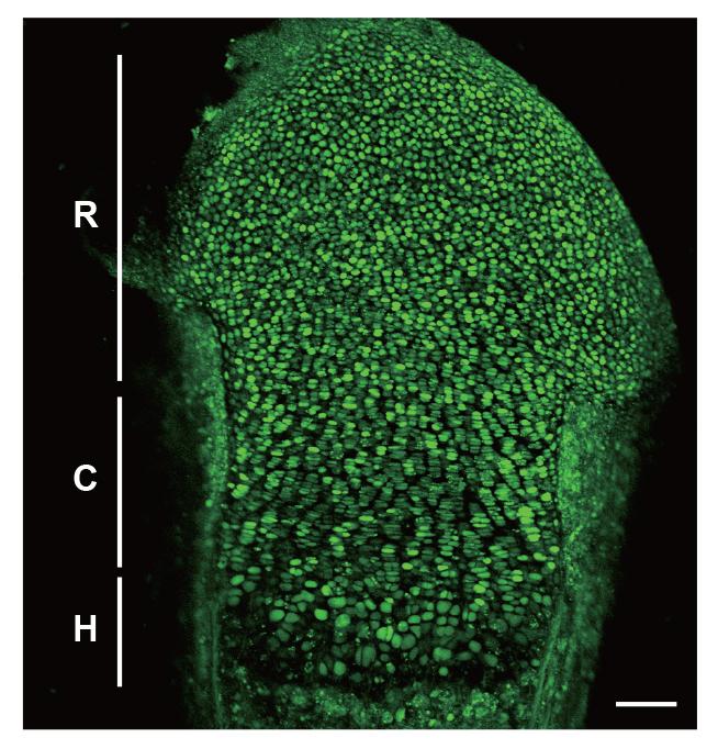 How Does Calcium Signaling Guide Proper Bone Growth? (1 of 1)