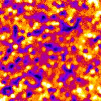 Retinal Pigment Epithelium
