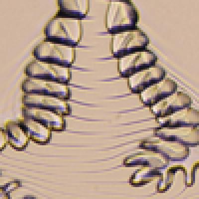 Film Instabilities in Microchannels