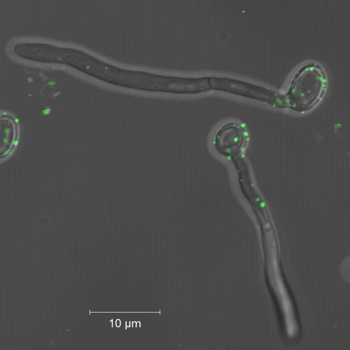 Fungal cells studded with membrane vesicles