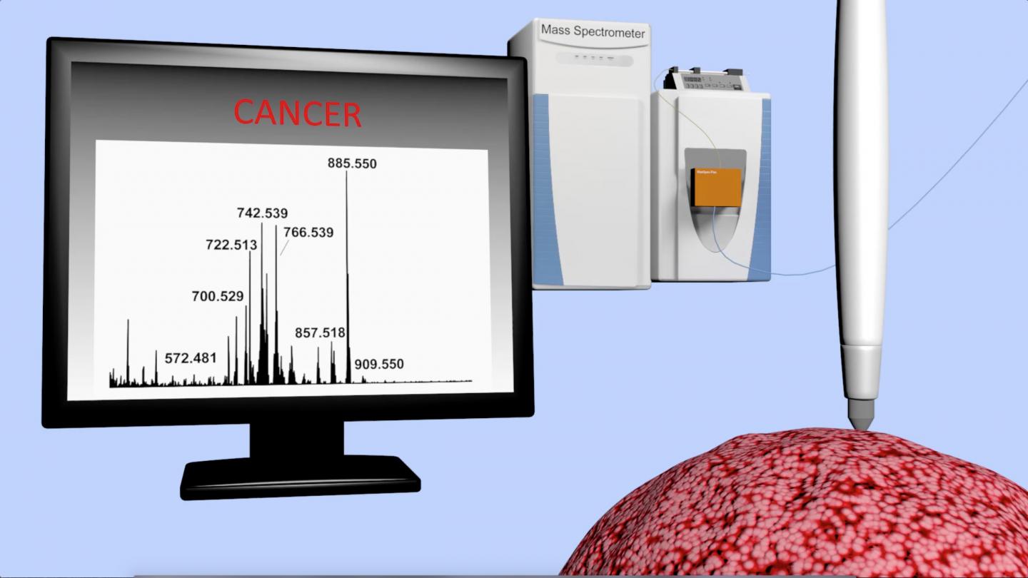 Handheld "Pen" May Bring Real-time Cancer Diagnosis to Surgeons' Fingertips (8 of 11)