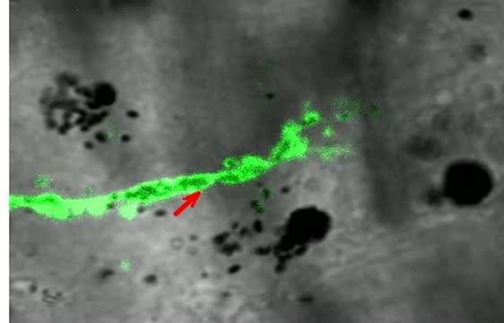 Melanin Migration 2