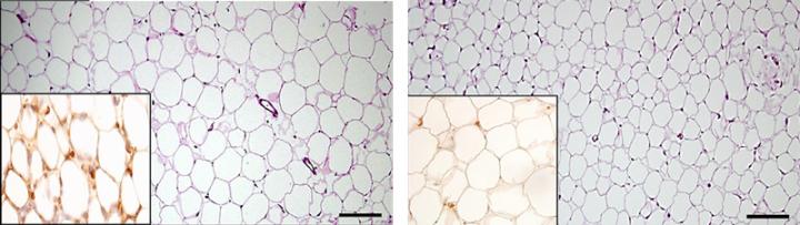 Fat Tissue Cells