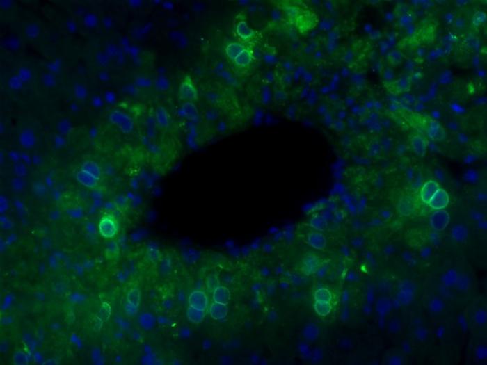 Mouse liver 72 hours after acetaminophen administration