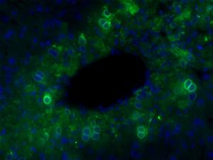 Mouse liver 72 hours after acetaminophen administration