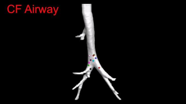 CF Lung