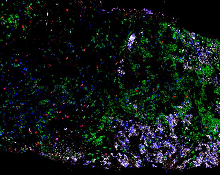 Gamma Lung_Tissue Sample