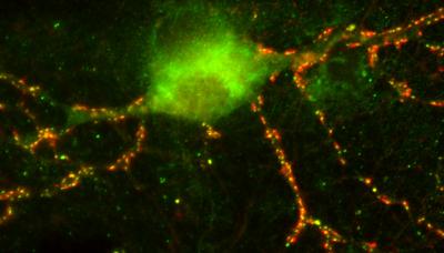 Nerve Cells