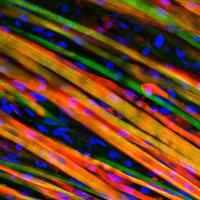 Implanted Muscle