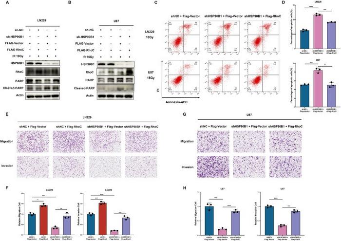 HSP90B1 promoted glioma radioresistance and migratory and invasive capabilities by regulating RhoC expression