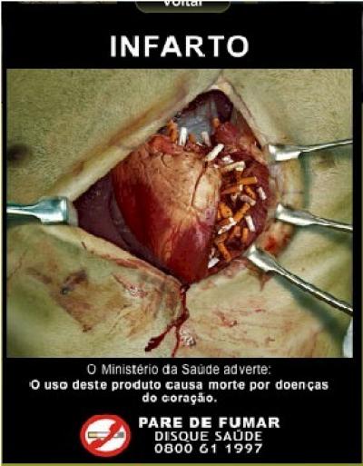 Infarcto