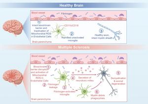 Mitochondrial ROS-mediated blood-brain barrier disruption and neuroinflammation in MS.