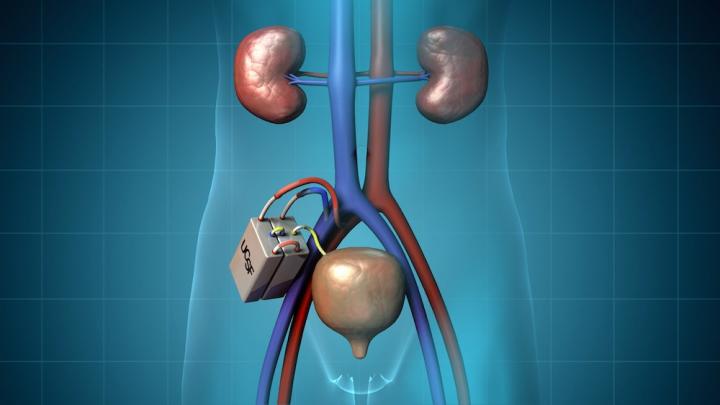 Kidney