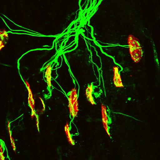 Neuromuscular Junction