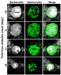 <em>In vivo</em> Imaging of Type 1 Diabetes Immunopathology Using Eye-Transplanted Islets (1 of 2)
