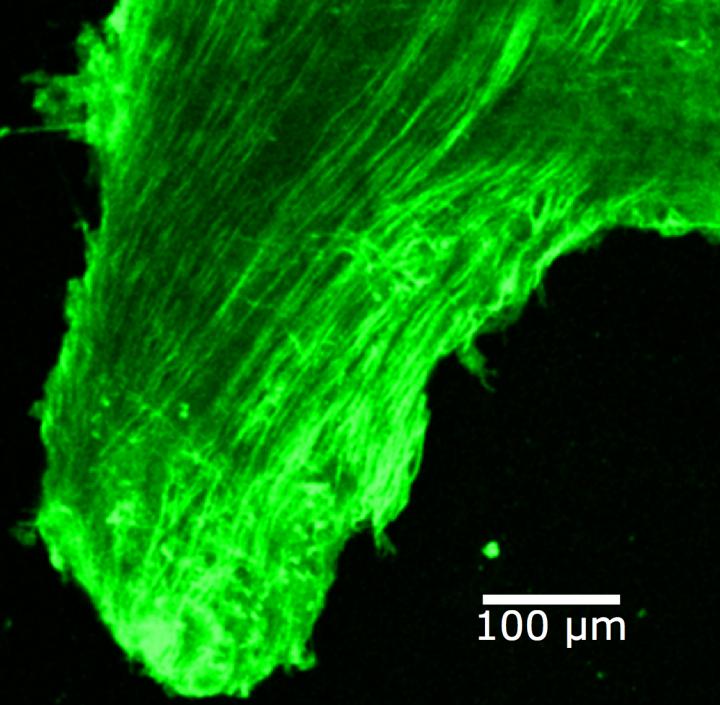 Nerve Cells