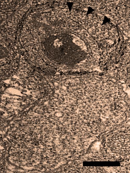 Infected & Uninfected Wolbachia Cells