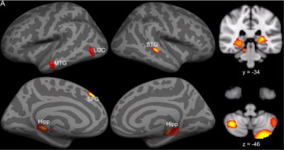 Brain Scan