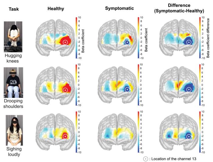 Same “Depressed” Body Movements, Opposite Brain Responses: KAIST Study Reveals Differences by Depressive Symptom Level
