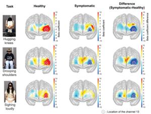 Same “Depressed” Body Movements, Opposite Brain Responses: KAIST Study Reveals Differences by Depressive Symptom Level